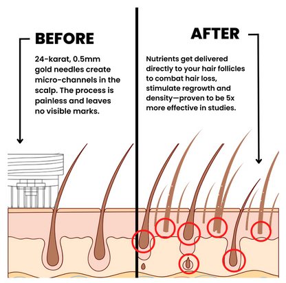 VOLTORA™ HAIR Regrowth Serum